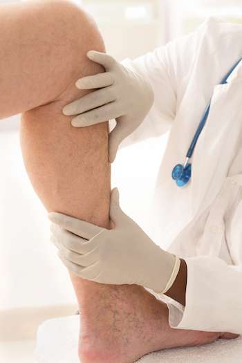 vein doctor treating man with varicose veins in legs